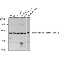 Somatostatin Receptor 2 (SSTR2) Rabbit pAb