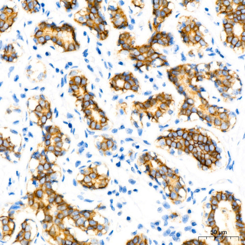 E-Cadherin mouse mAb