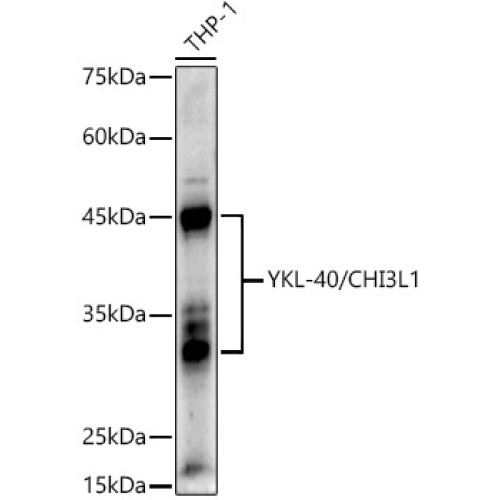 YKL-40/CHI3L1 Rabbit pAb