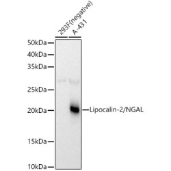 Lipocalin-2/NGAL Rabbit pAb