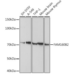 FAM160B2 Rabbit pAb