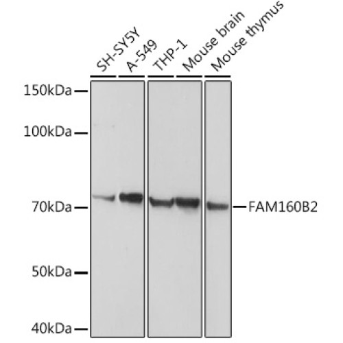 FAM160B2 Rabbit pAb