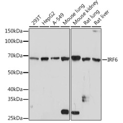IRF6 Rabbit mAb