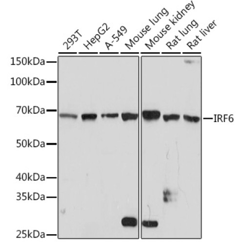IRF6 Rabbit mAb