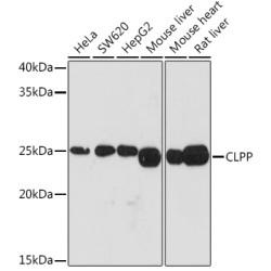 CLPP Rabbit mAb