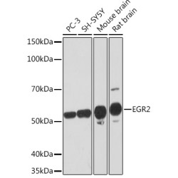 EGR2 Rabbit mAb