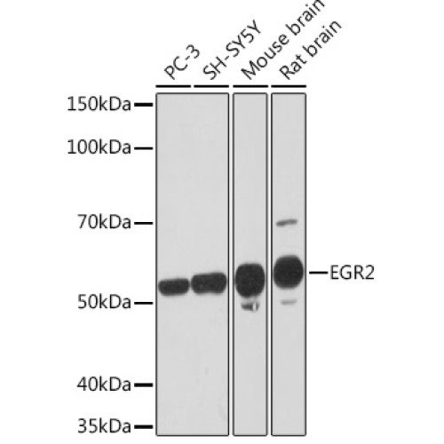 EGR2 Rabbit mAb