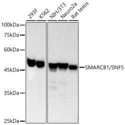 [KO Validated] SMARCB1/SNF5 Rabbit mAb