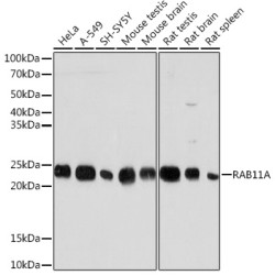 RAB11A Rabbit mAb