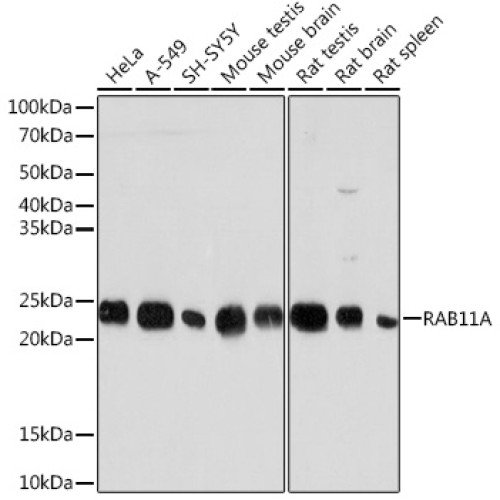RAB11A Rabbit mAb