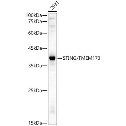 STING/TMEM173 Rabbit pAb