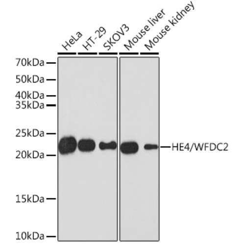 HE4/WFDC2 Rabbit mAb