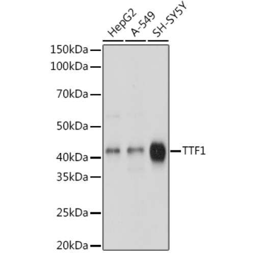 TTF-1 Rabbit mAb