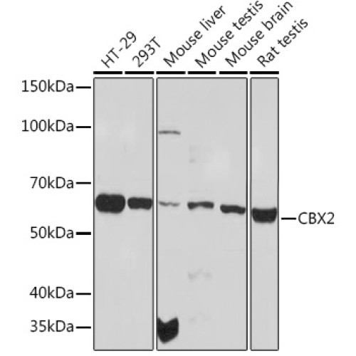 CBX2 Rabbit mAb