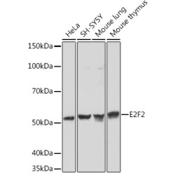 E2F2 Rabbit mAb