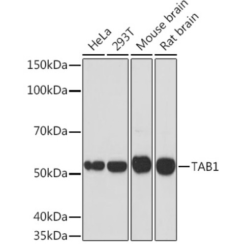 TAB1 Rabbit mAb