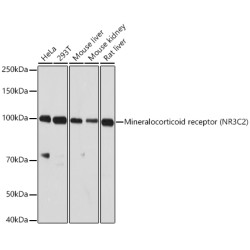 Mineralocorticoid receptor (NR3C2) Rabbit pAb