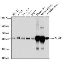 ALDH6A1 Rabbit pAb