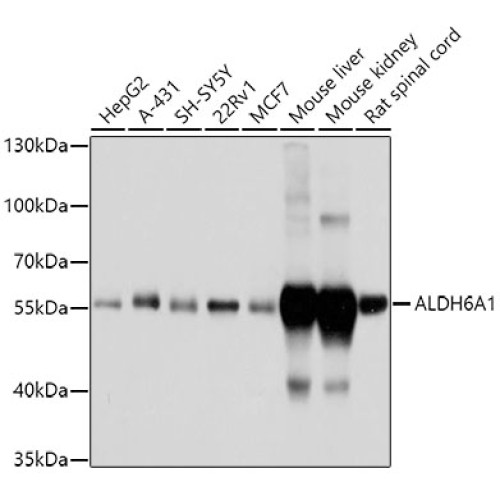 ALDH6A1 Rabbit pAb