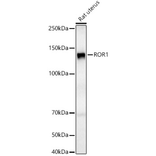 ROR1 Rabbit pAb