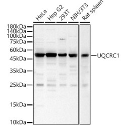 UQCRC1 Rabbit pAb