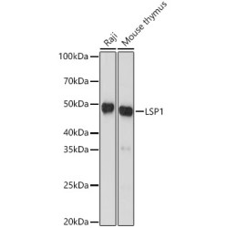 LSP1 Rabbit mAb