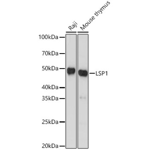 LSP1 Rabbit mAb
