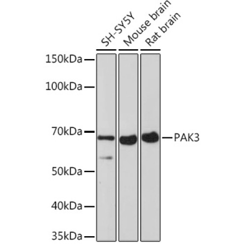 PAK3 Rabbit mAb