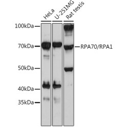 RPA70/RPA1 Rabbit mAb