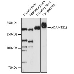 ADAMTS13 Rabbit mAb