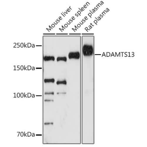 ADAMTS13 Rabbit mAb