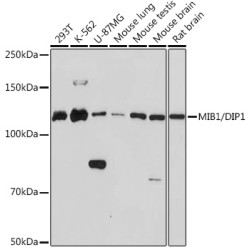 MIB1/DIP1 Rabbit mAb