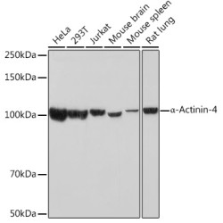 α-Actinin-4 Rabbit mAb