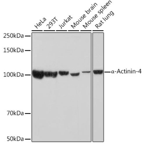 α-Actinin-4 Rabbit mAb