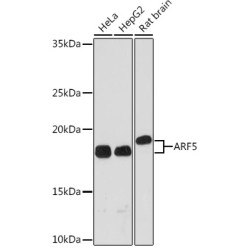 ARF5 Rabbit mAb