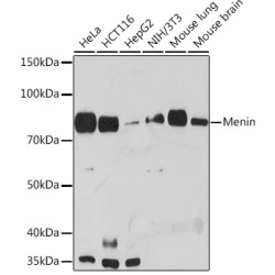 Menin Rabbit mAb
