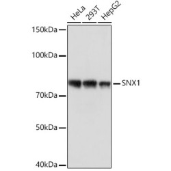 SNX1 Rabbit mAb