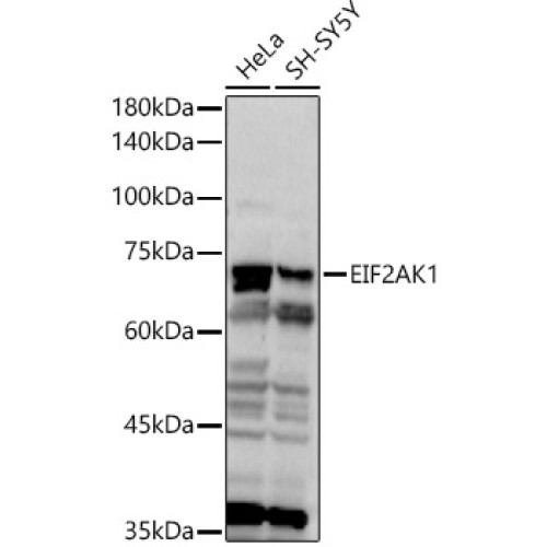 [KO Validated] EIF2AK1 Rabbit pAb