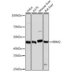 RRM2 Rabbit mAb