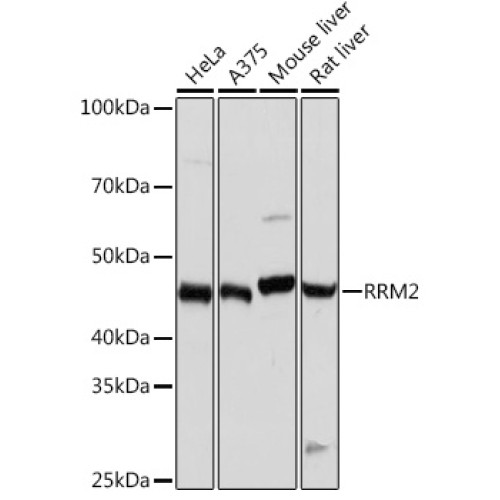 RRM2 Rabbit mAb