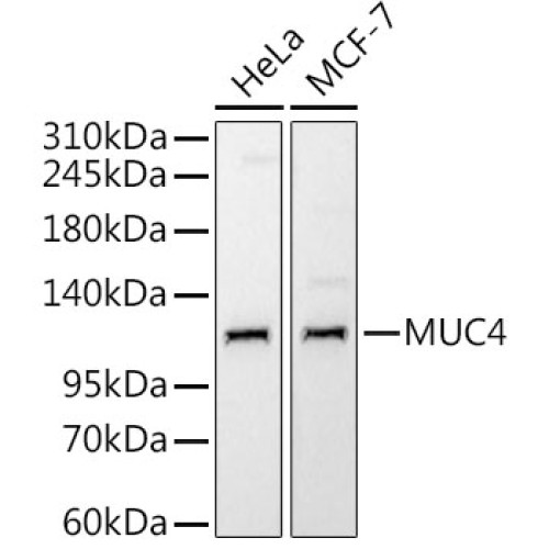 MUC4 Rabbit mAb