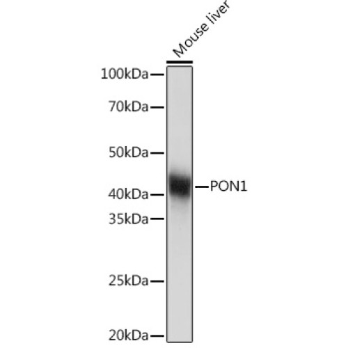 PON1 Rabbit mAb