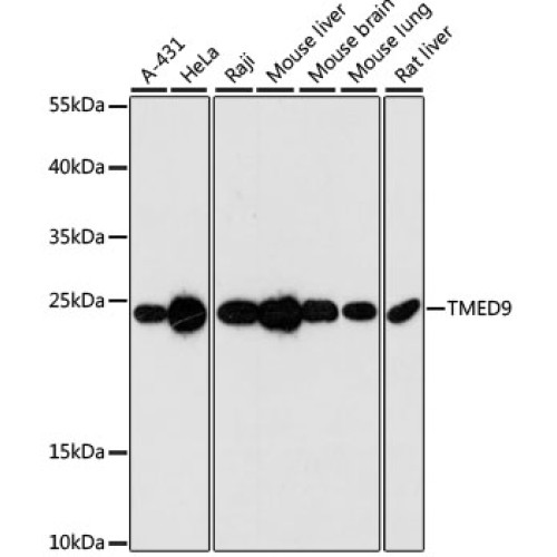 TMED9 Rabbit pAb