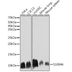 S100A6 Rabbit mAb
