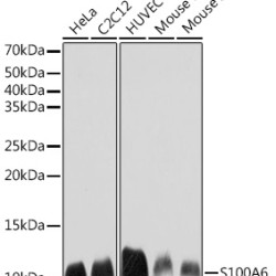 S100A6 Rabbit mAb