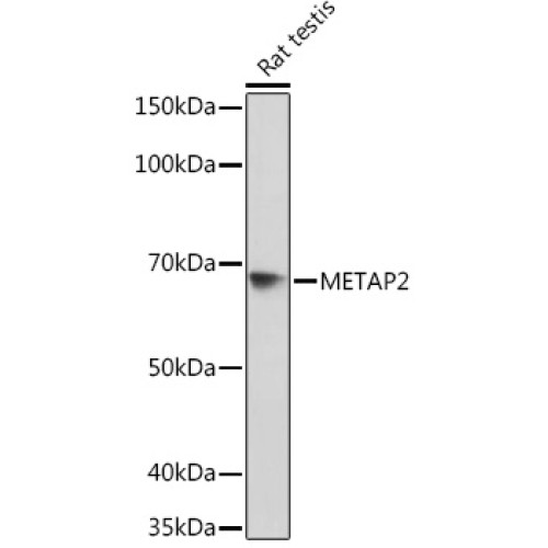 METAP2 Rabbit mAb