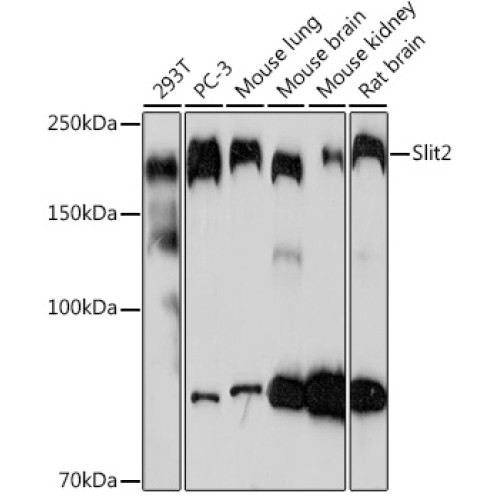 Slit2 Rabbit mAb