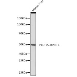 PEDF/SERPINF1 Rabbit mAb