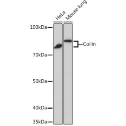 Coilin Rabbit mAb