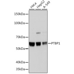 PTBP1 Rabbit mAb